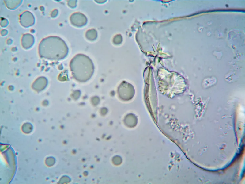 Flushing, Fog, and a Hundred Other Complaints: The Diagnostic Blind Spot That Is Mast Cell Activation Syndrome